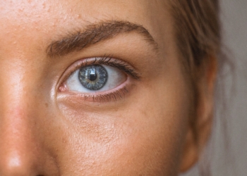 Easy Ways to Get Rid of Acne Fast and Naturally