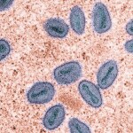 W.H.O Declares Mpox a Global Health Emergency: Critical Facts You Need to Know 29 | Mania Africa | maniainc.com 172709670366f1677f9cd8b | Mania Africa: News, Sports, Tech, Movies, and Lifestyle | maniainc.com
