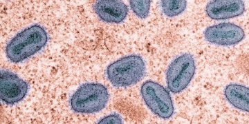 W.H.O Declares Mpox a Global Health Emergency: Critical Facts You Need to Know