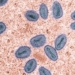 W.H.O Declares Mpox a Global Health Emergency: Critical Facts You Need to Know 24 | Mania Africa | maniainc.com W.H.O Declares Mpox a Global Health Emergency: Critical Facts You Need to Know