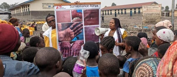W.H.O Declares Mpox a Global Health Emergency: Critical Facts You Need to Know 5 | Mania Africa | maniainc.com Medical teams in Congo are racing against the clock to try and contain the MPox outbreak | W.H.O Declares Mpox a Global Health Emergency | Mania Health