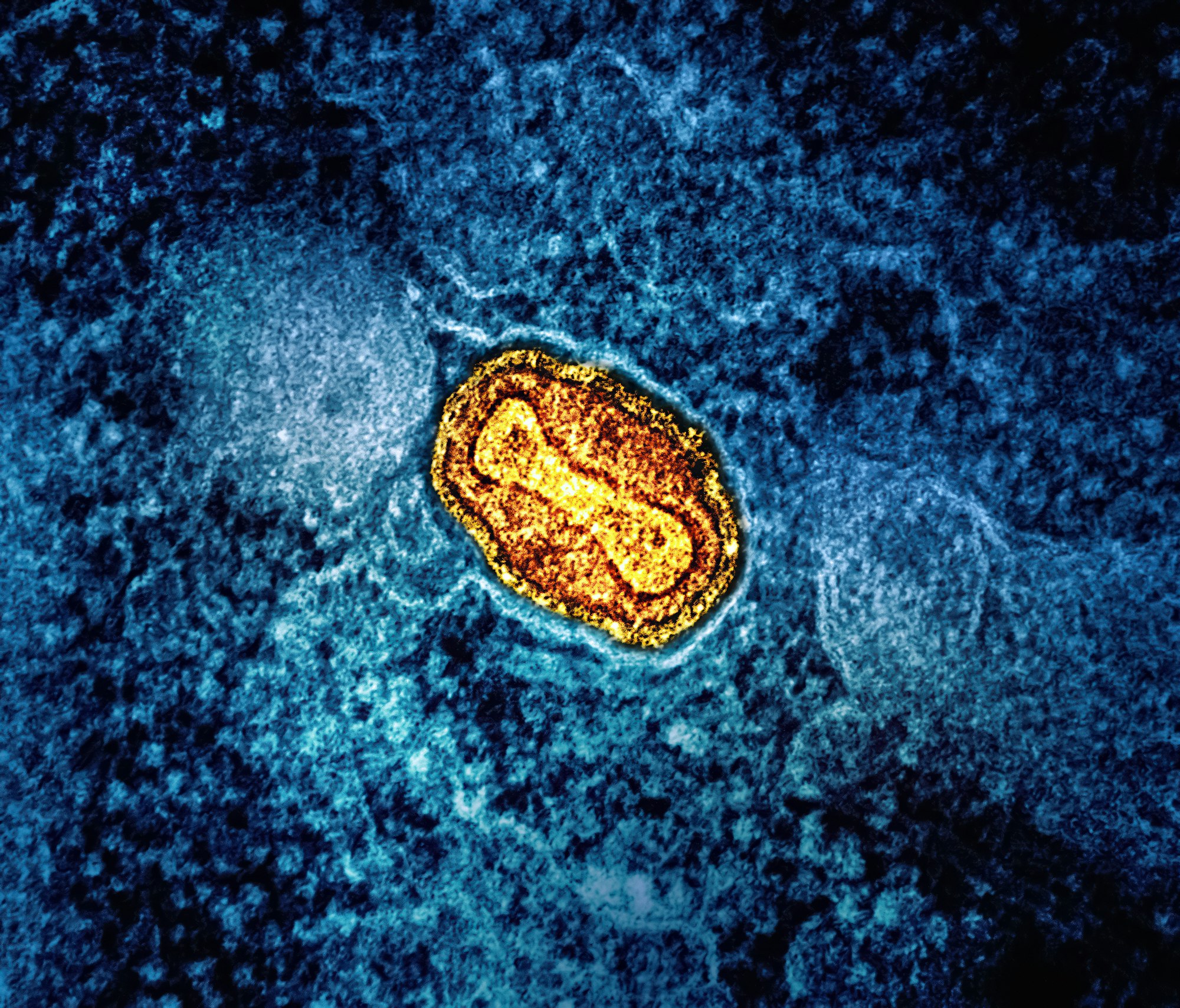W.H.O Declares Mpox a Global Health Emergency: Critical Facts You Need to Know 8 | Mania Africa | maniainc.com Mpox Mutation and New Variants | Mpox Health Risks and Global Impact | Mania Health